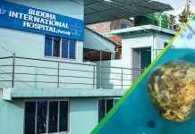 घोराहीको बुद्ध हस्पिटलमा ३५ एमएमको पत्थरीको सफल अपरेशन