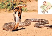 दाङमा सर्पको टोकाइबाट २२ महिनाका बालकको मृत्यु