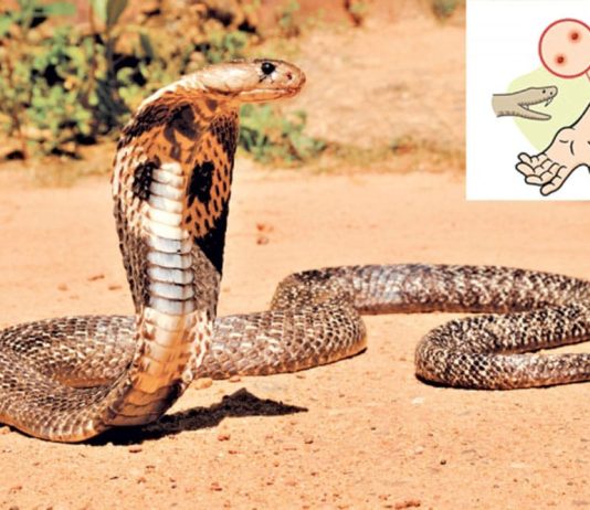 दाङमा सर्पको टोकाइबाट २२ महिनाका बालकको मृत्यु